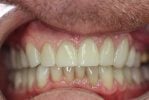 hammond dental after