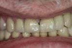 hammond dental after