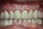 hammond dental after