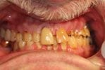 hammond dental before