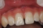 hammond dental before
