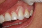 hammond dental after