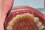 hammond dental before